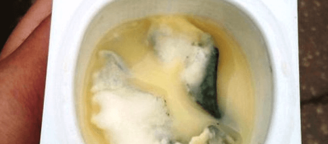 Отравление просроченным йогуртом