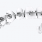 Стоматологические КЛКТ томографы – принцип работы, применение