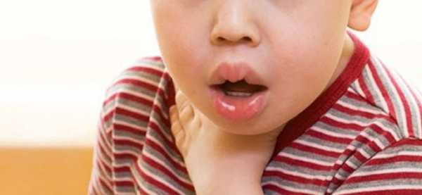 Анафилаксия — проявление аллергии, которое угрожает жизни