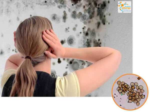 Что делать при поллинозе: рекомендации тем, у кого аллергия на пыльцу и споры грибов