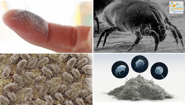 Аллергия на клещей домашней пыли может украсть ваш сон