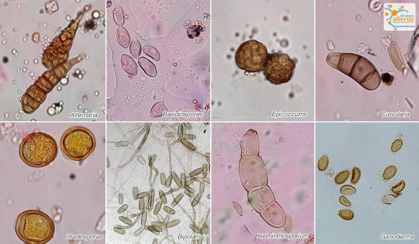 Виновники осенней астмы: почему споры грибов становятся важнейшим аллергеном