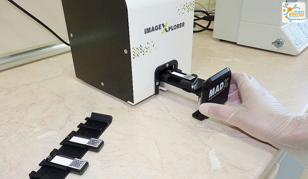 Что вызывает зуд во рту? Причины, симптомы и лечение — от аллергии до дрожжевой инфекции