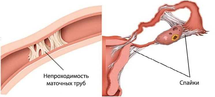 3-kartinka 3-kartinka