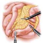 Ликопид в борьбе за здоровье кожи!