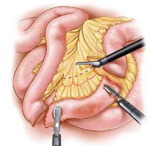 Почему здоровье кожи и крепкий иммунитет начинаются с кишечника